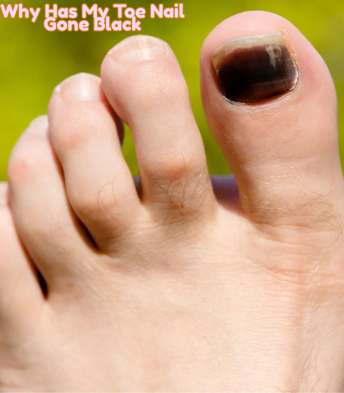 Why Has My Toe Nail Gone Black? 8 Shocking Causes & Fixes